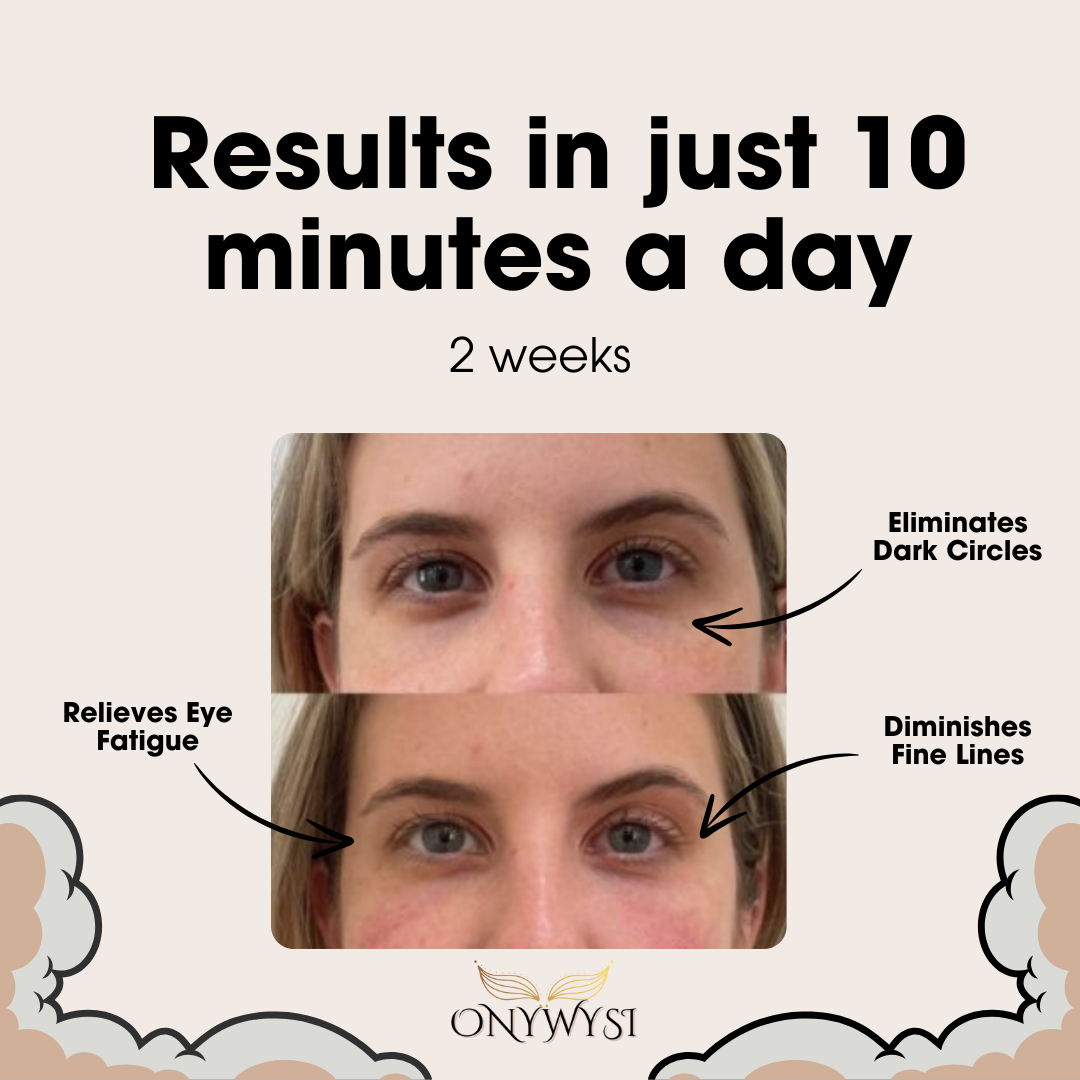 Onywysi Pro™ Eye Massager