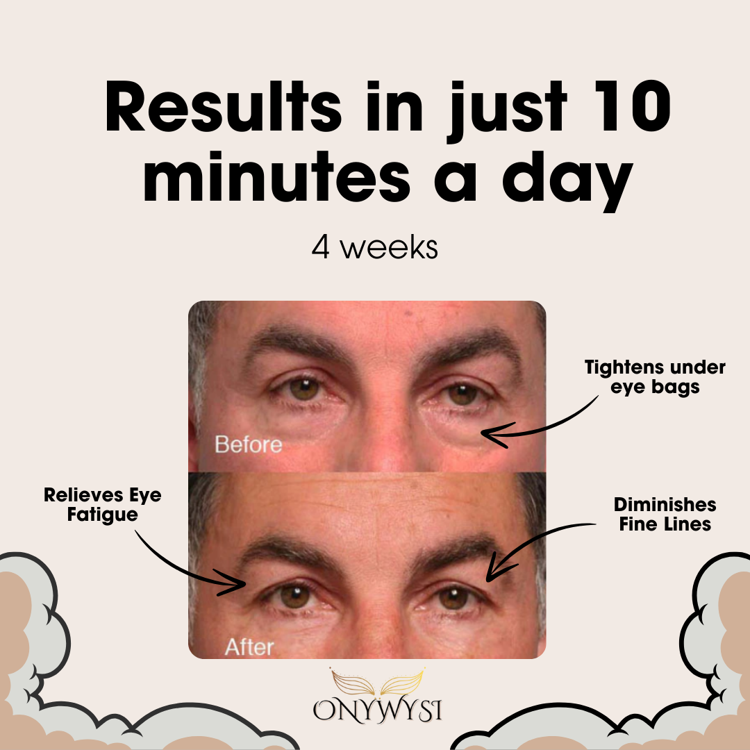 Onywysi Pro™ Eye Massager