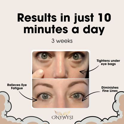 Onywysi Pro™ Eye Massager